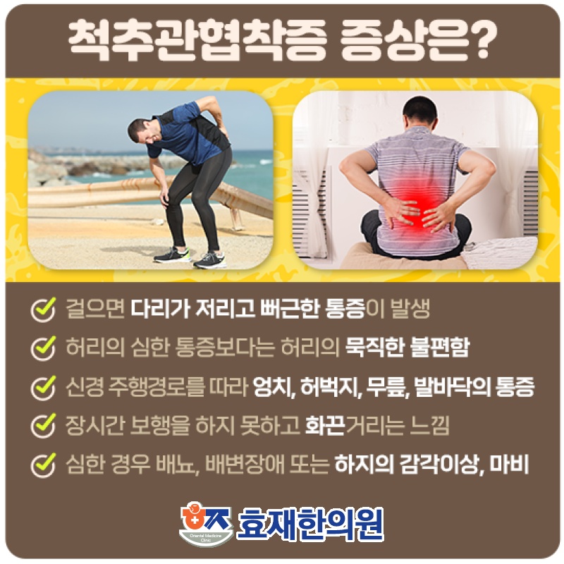 척추관협착증에 따른 허리 통증 관리 방법 알아보기