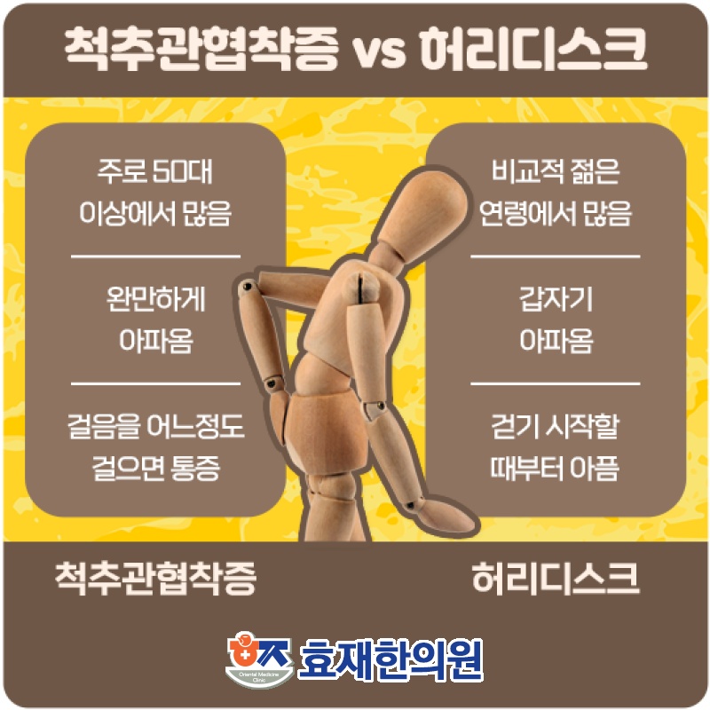 척추관협착증에 따른 허리 통증 관리 방법 알아보기