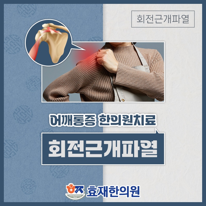 회전근개파열로 인한 어깨 통증, 살펴볼 관리 기준