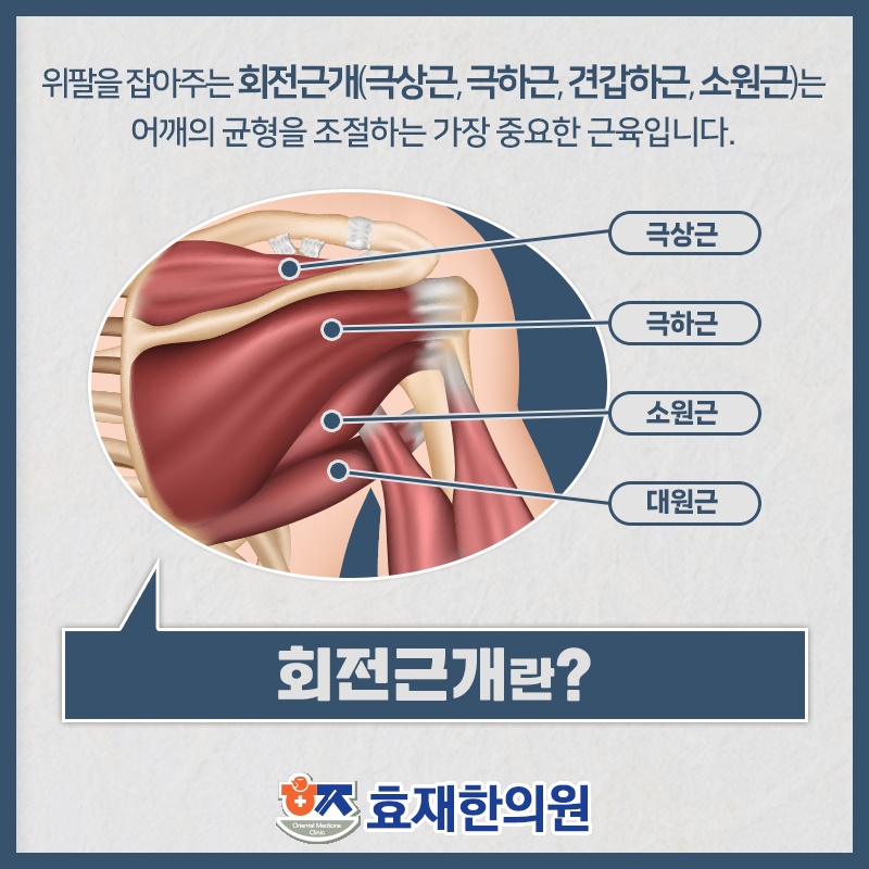 회전근개파열로 인한 어깨 통증, 살펴볼 관리 기준